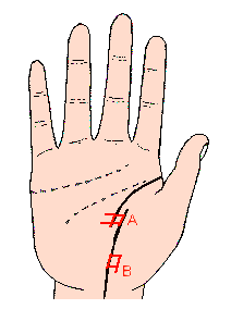 ������(xi��n)�����D��